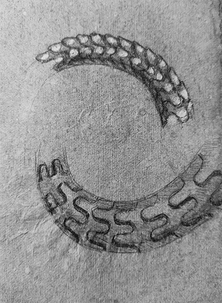 octopus-leg-spine